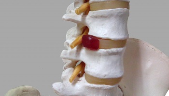 骨・関節・筋肉の病気と症状